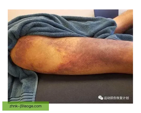 加亚频繁遭遇肌肉拉伤困扰如何影响他的职业生涯与恢复计划